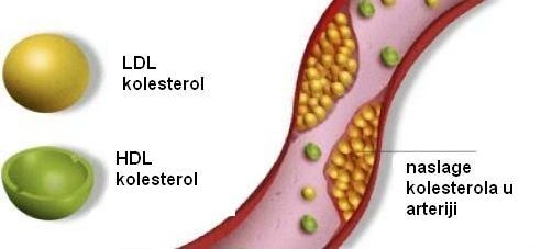 KolesterolHDLLDL